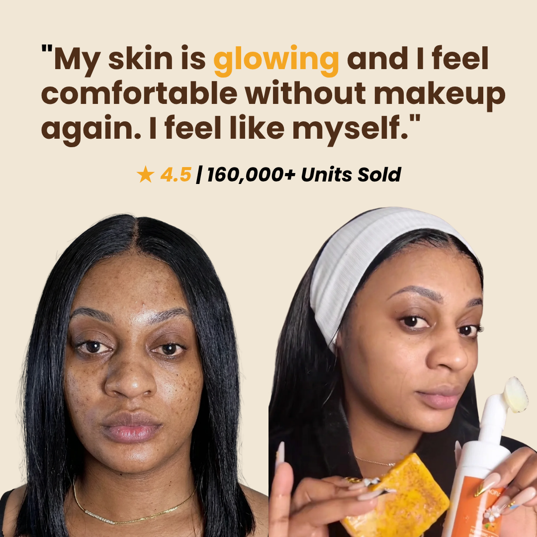 Kojic Acid Glow Set